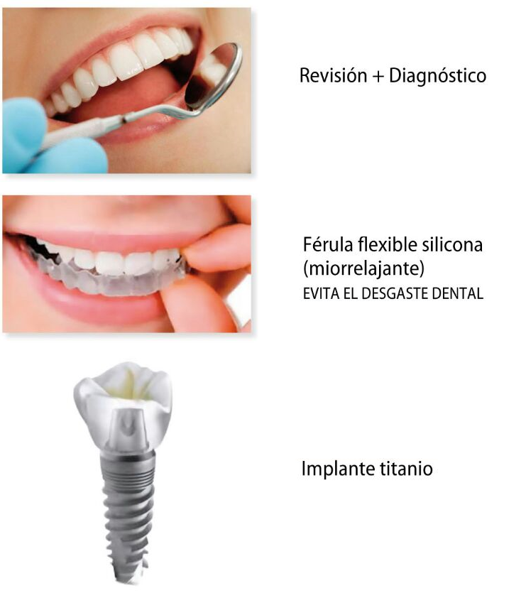Servicios Clínica Dental Garcia Bernardo